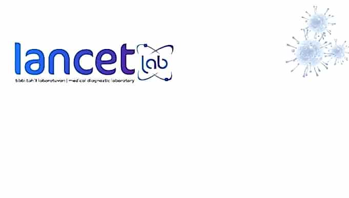 Lancet Laboratuvarı